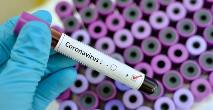 COVID-19: A Lady Narrated A Story Of How Coronavirus Lockdown Saved Her Friend