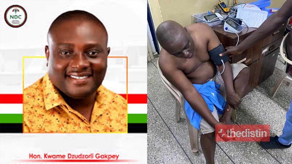 Armed Men Attack Keta MP-elect Kwame Dzudzorli Gakpe In His House | Details