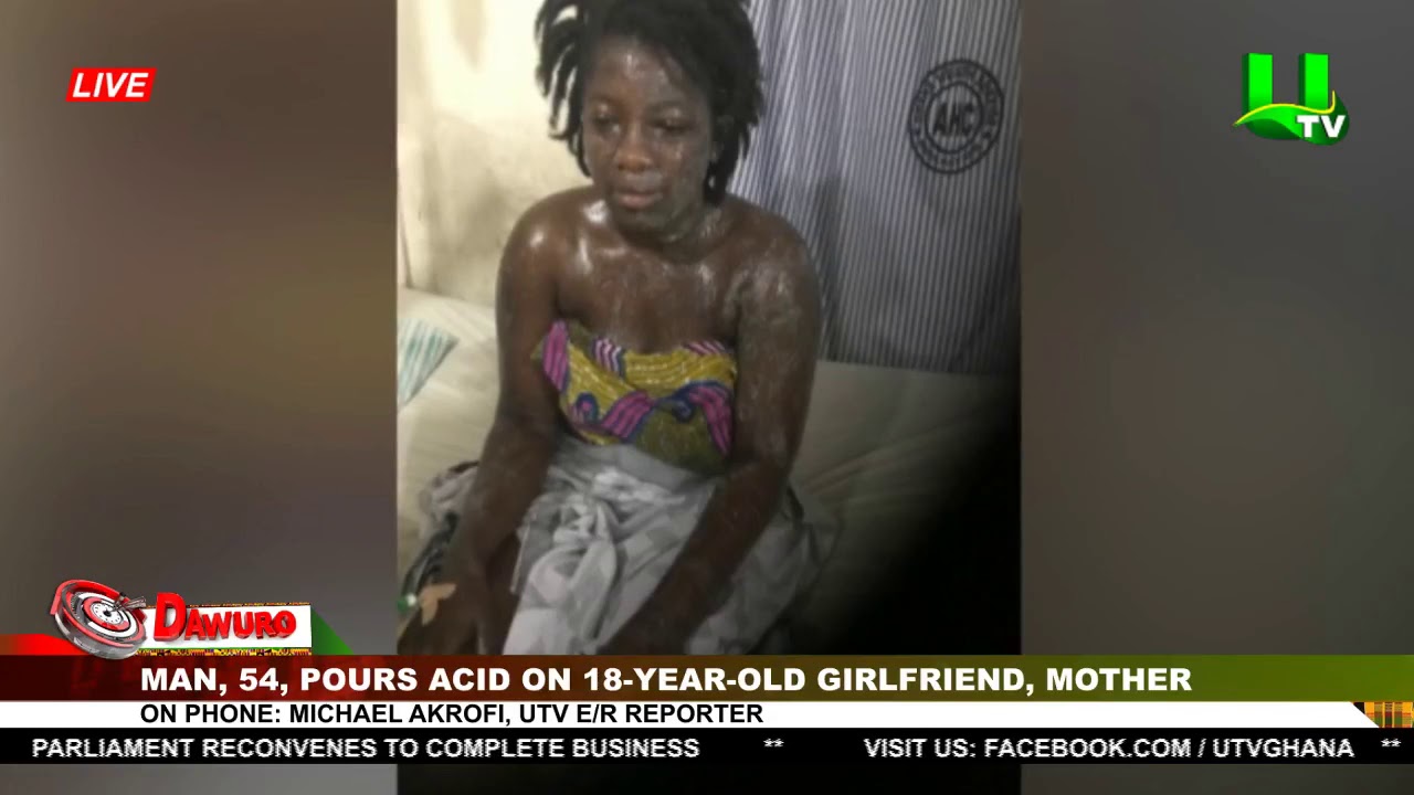 Angry Sugar Daddy Pours Acid On His 18-year-old Girlfriend And Her Mother (Video)