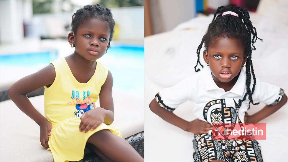 Meet Rebecca Dumeh: Ghanaian Child With Blue Eye Modelling To Raise Funds For Surgery And Create Awareness For Her Condition (Photos)